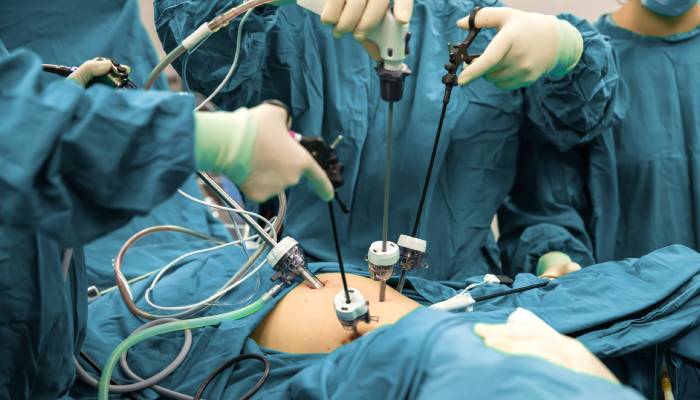 Instruments Used in Pyeloplasty Surgery